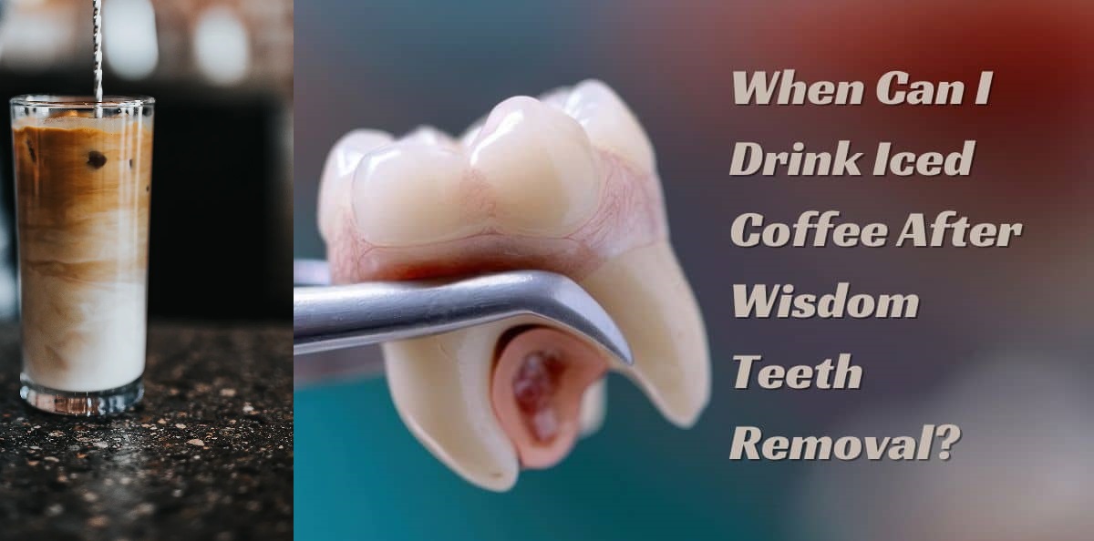 When Can You Drink Coffee After Wisdom Teeth Removal? Tips for Recovery