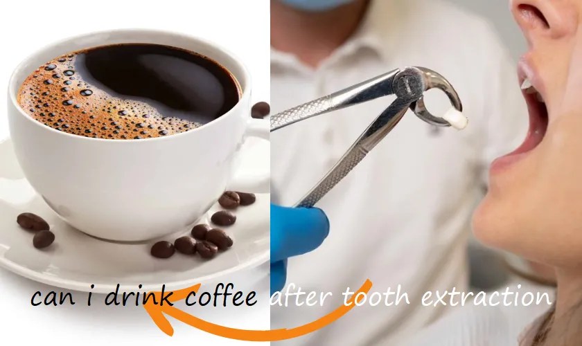 Just Got a Tooth Out: When Can I Drink Coffee After Tooth Extraction?